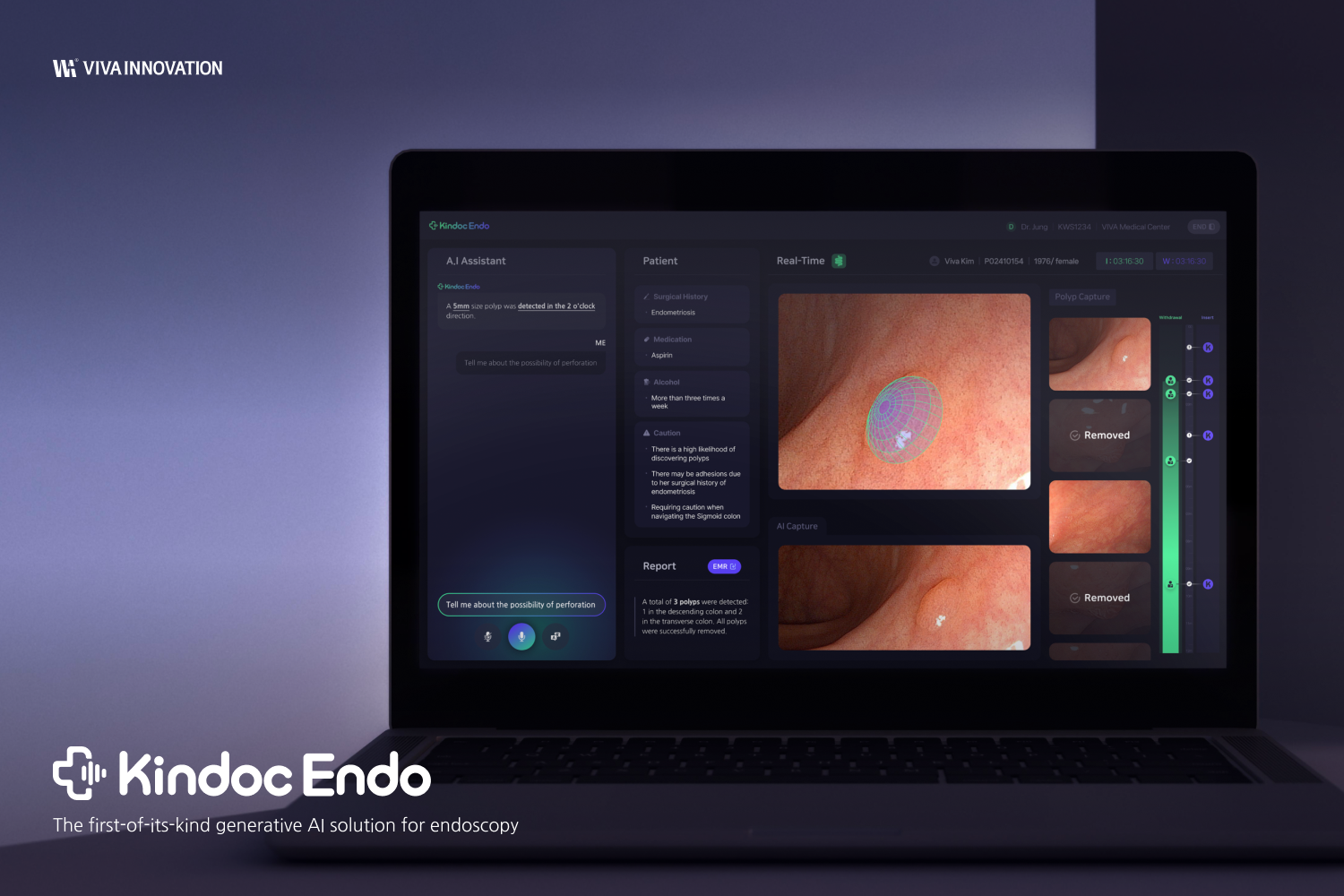 KINDOC Endo - The generative AI solution for endoscopy
